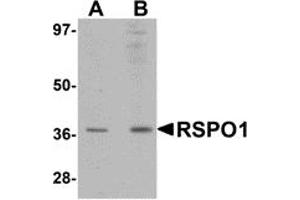 Western Blotting (WB) image for anti-R-Spondin 1 (RSPO1) (N-Term) antibody (ABIN1031546) (RSPO1 anticorps  (N-Term))