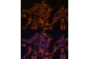 Immunofluorescence analysis of U-2 OS cells using HSD17B8 Polyclonal Antibody  at dilution of 1:100 (40x lens). (HSD17B8 anticorps  (AA 1-261))