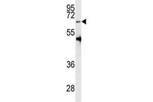 Western blot analysis of PRMT5 antibody and HL-60 lysate (PRMT5 anticorps  (AA 473-499))