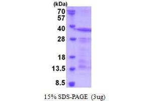 SDS-PAGE (SDS) image for Sialophorin (SPN) (AA 20-253) protein (His tag) (ABIN5853218) (CD43 Protein (AA 20-253) (His tag))