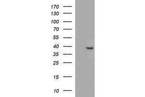 Image no. 1 for anti-Fatty Acid 2-Hydroxylase (FA2H) antibody (ABIN1500828) (FA2H anticorps)