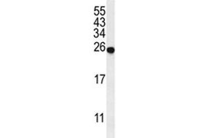 Western blot analysis of SPR antibody and mouse liver tissue lysate. (SPR anticorps  (AA 231-260))