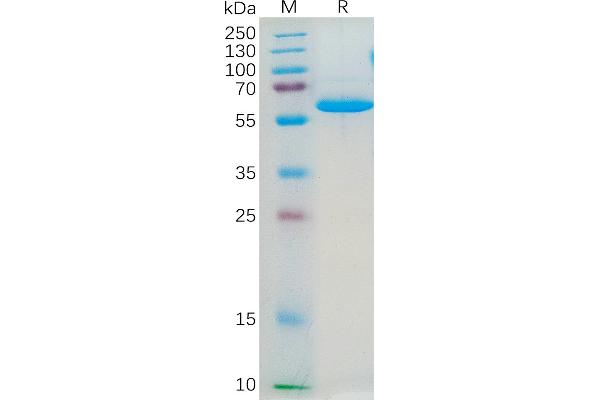 F11R Protein (AA 28-238) (Fc Tag)