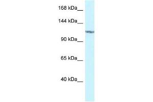 Western Blot showing PKN2 antibody used at a concentration of 1 ug/ml against 293T Cell Lysate (PKN2 anticorps  (C-Term))