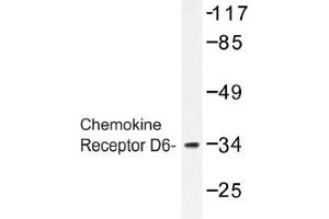 Image no. 1 for anti-Chemokine Binding Protein 2 (CCBP2) antibody (ABIN317628) (CCBP2 anticorps)