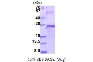 SDS-PAGE (SDS) image for Tumor Necrosis Factor Receptor Superfamily, Member 1A (TNFRSF1A) (AA 22-211) protein (His tag) (ABIN5853971) (TNFRSF1A Protein (AA 22-211) (His tag))