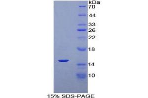 SDS-PAGE analysis of Human Klotho beta Protein. (Klotho beta Protein (KLB))