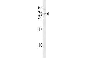 Western Blotting (WB) image for anti-Interleukin 28B (Interferon, lambda 3) (IL28B) antibody (ABIN2999039) (IL28B anticorps)