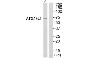 Western blot analysis of extracts from Jurkat cells, using ATG16L1 antibody. (ATG16L1 anticorps  (Internal Region))