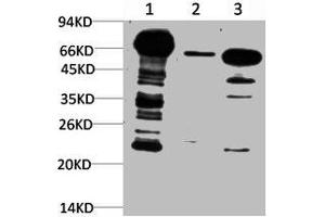 Western blot analysis of 1) Hela Cell Lysate, 2) 3T3 Cell Lysate, 3) Rat Brain Tissue Lysate using Ubiquitin Mouse mAb diluted at 1:1000. (Ubiquitin anticorps)