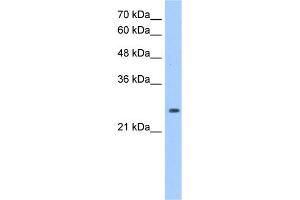 WB Suggested Anti-PRDX6 Antibody Titration:  1. (Peroxiredoxin 6 anticorps  (Middle Region))