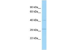 WB Suggested Anti-Tsc22d4 Antibody Titration: 1. (TSC22D4 anticorps  (N-Term))