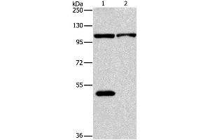 Western Blotting (WB) image for anti-NLR Family, Pyrin Domain Containing 3 (NLRP3) antibody (ABIN2427661) (NLRP3 anticorps)