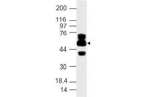 Image no. 1 for anti-ATG16 Autophagy Related 16-Like 1 (ATG16L1) (AA 35-260) antibody (ABIN5027030) (ATG16L1 anticorps  (AA 35-260))