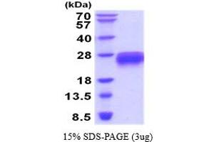 SDS-PAGE (SDS) image for TNF Receptor Superfamily, Member 6 (FAS) (AA 26-173) protein (His tag) (ABIN5854470) (FAS Protein (AA 26-173) (His tag))