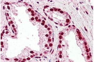 Human Prostate (formalin-fixed, paraffin-embedded) stained with IRF6 antibody ABIN461925 at 2. (IRF6 anticorps  (AA 455-467))