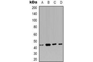 Western blot analysis of Carbonic Anhydrase 12 expression in HEK293T (A), PC3 (B), MCF7 (C), NIH3T3 (D) whole cell lysates. (CA12 anticorps)