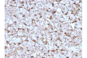 Formalin-fixed, paraffin-embedded human Pituitary stained with Prolactin Mouse Monoclonal Antibody (PRL/2643). (Prolactin anticorps  (AA 63-201))