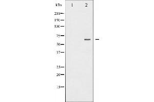 Western Blotting (WB) image for anti-Nuclear Factor-kB p65 (NFkBP65) antibody (ABIN6263616)