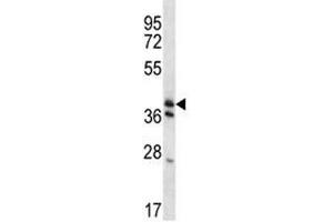 KLF2 antibody western blot analysis in mouse heart tissue lysate. (KLF2 anticorps  (AA 13-42))