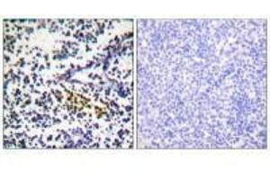 Immunohistochemistry analysis of paraffin-embedded human tonsil tissue using NYREN18 antibody. (NUB1 anticorps  (C-Term))