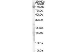 Western Blotting (WB) image for anti-Sp1 Transcription Factor (SP1) (AA 68-82) antibody (ABIN291116) (SP1 anticorps  (AA 68-82))