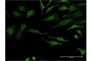 Immunofluorescence of monoclonal antibody to FOXO1 on HeLa cell. (FOXO1 anticorps  (AA 452-555))