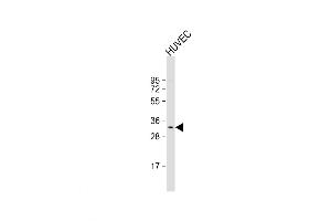 Western Blot at 1:1000 dilution + HUVEC whole cell lysate Lysates/proteins at 20 ug per lane. (CNOT8 anticorps  (N-Term))