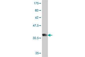 Western Blot detection against Immunogen (38. (LIFR anticorps  (AA 45-154))