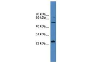 Image no. 1 for anti-SMAD, Mothers Against DPP Homolog 2 (SMAD2) (C-Term) antibody (ABIN6745339) (SMAD2 anticorps  (C-Term))