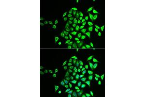 Immunofluorescence analysis of U2OS cell using NAPG antibody. (NAPG anticorps)