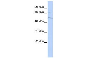 CHRNA4 antibody used at 1 ug/ml to detect target protein. (CHRNA4 anticorps  (N-Term))