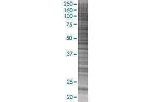 ZNF22 transfected lysate. (ZNF22 293T Cell Transient Overexpression Lysate(Denatured))