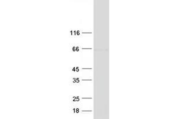 EVI2A Protein (Transcript Variant 2) (Myc-DYKDDDDK Tag)