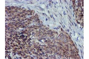 Immunohistochemistry (IHC) image for anti-Arachidonate 15-Lipoxygenase (ALOX15) antibody (ABIN1496358) (ALOX15 anticorps)