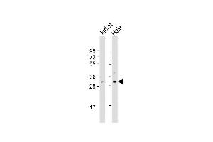 All lanes : Anti-CDK1 Antibody at 1:500-1:1000 dilution Lane 1: Jurkat whole cell lysate Lane 2: Hela whole cell lysate Lysates/proteins at 20 μg per lane. (CDK1 anticorps  (AA 1-297))