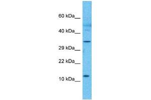 Western Blotting (WB) image for anti-RP3-473B4.1 (N-Term) antibody (ABIN2785035) (RP3-473B4.1 (N-Term) anticorps)