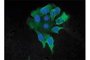 Human pancreatic carcinoma cell line MIA PaCa-2 was stained with Mouse Anti-Cytokeratin 8-FITC followed by DAPI. (KRT8 anticorps  (C-Term) (FITC))