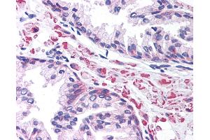 Anti-LEF1 antibody IHC of human prostate. (LEF1 anticorps  (AA 51-100))