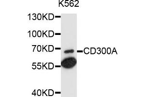 Western blot analysis of extracts of K-562 cells, using CD300A antibody (ABIN6003714) at 1/1000 dilution. (CD300a anticorps)