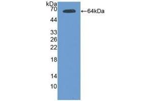 Detection of Recombinant Tie2, Mouse using Polyclonal Antibody to TEK Tyrosine Kinase, Endothelial (Tie2) (TEK anticorps)