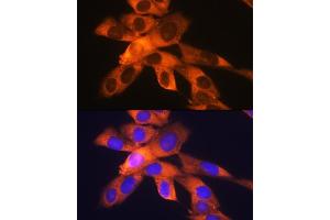 Immunofluorescence analysis of NIH-3T3 cells using RPS19 Rabbit mAb (ABIN1681275, ABIN3017969, ABIN3017970 and ABIN7101552) at dilution of 1:100 (40x lens). (RPS19 anticorps)