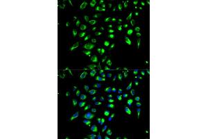 Immunofluorescence analysis of MCF-7 cells using CD86 antibody (ABIN5970542). (CD86 anticorps)