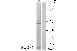 Western blot analysis of extracts from Jurkat cells, using BUD31 antibody. (BUD31 anticorps  (Internal Region))