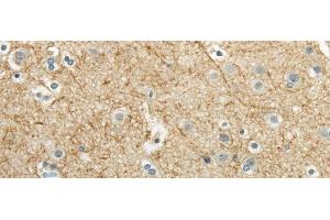 Immunohistochemistry of paraffin-embedded Human brain using WNT2 Polyclonal Antibody at dilution of 1/40 (WNT2 anticorps)