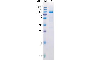 Human Protein, hFc Tag on SDS-PAGE under reducing condition. (LAG3 Protein (AA 23-245) (Fc Tag))