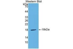 Detection of Recombinant CTLA4, Mouse using Polyclonal Antibody to Cytotoxic T-Lymphocyte Associated Antigen 4 (CTLA4) (CTLA4 anticorps  (AA 45-185))