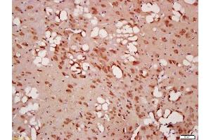 Immunohistochemistry (Paraffin-embedded Sections) (IHC (p)) image for anti-Beclin 1, Autophagy Related (BECN1) (AA 201-330) antibody (ABIN675384)