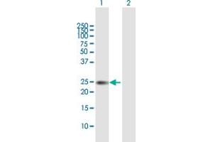 Western Blot analysis of TIMP1 expression in transfected 293T cell line by TIMP1 MaxPab polyclonal antibody. (TIMP1 anticorps  (AA 1-207))
