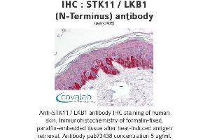 Image no. 1 for anti-serine/threonine Kinase 11 (STK11) antibody (ABIN1739721) (LKB1 anticorps)